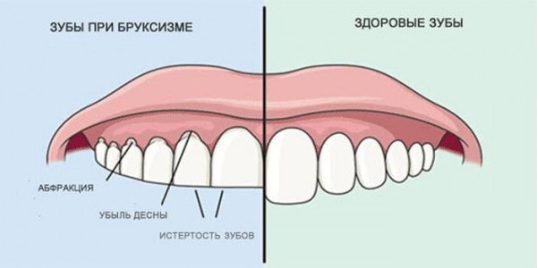 10 неожиданных симптомов стресса