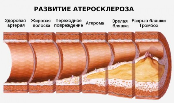 Чем полезен чайный гриб