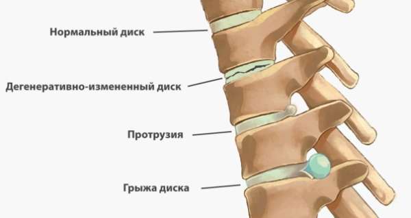 Обратная гиперэкстензия. Техника для ягодиц