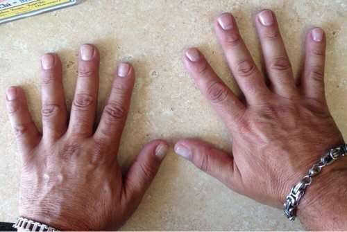 Как определить характер мужчины по ногтям