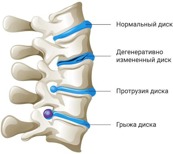 Поза верблюда в йоге. Фото, польза, техника